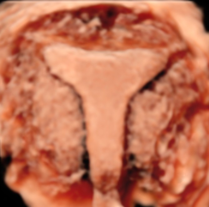 echo gyneco site centred echographie 0001